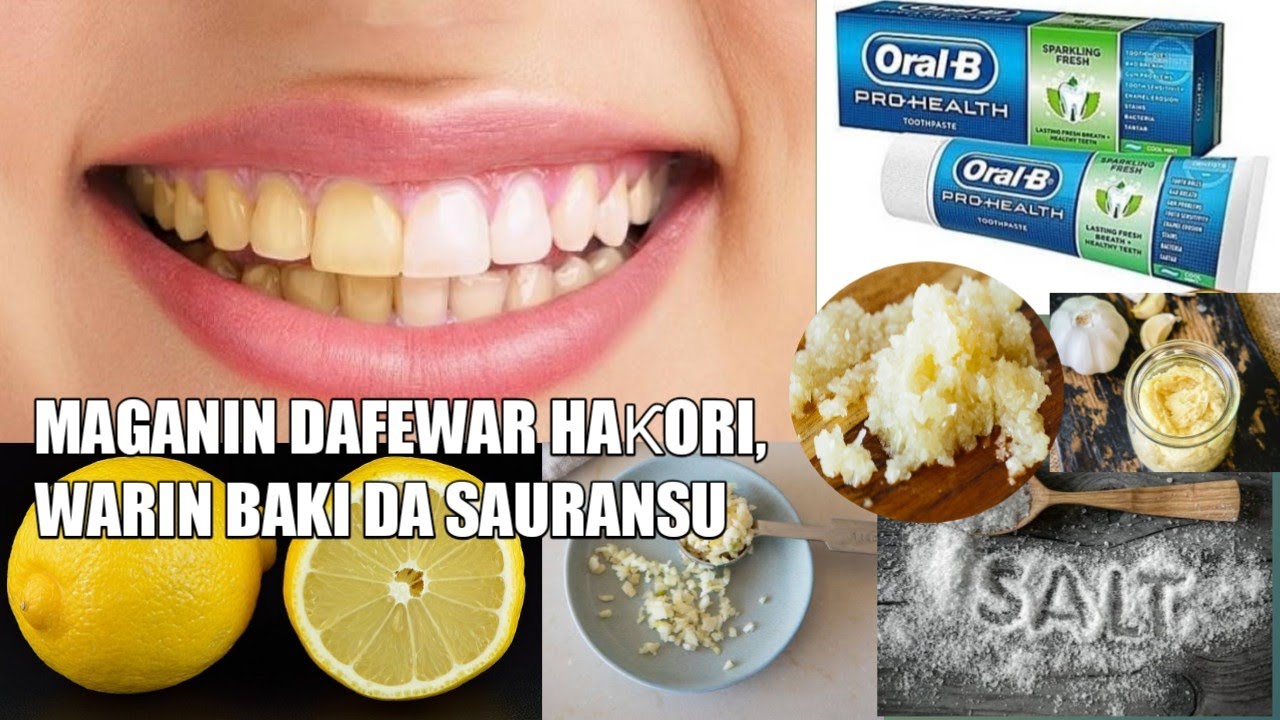 Maganin dafewar Hakora, warin baki, Amosanin baki da Sauran Su