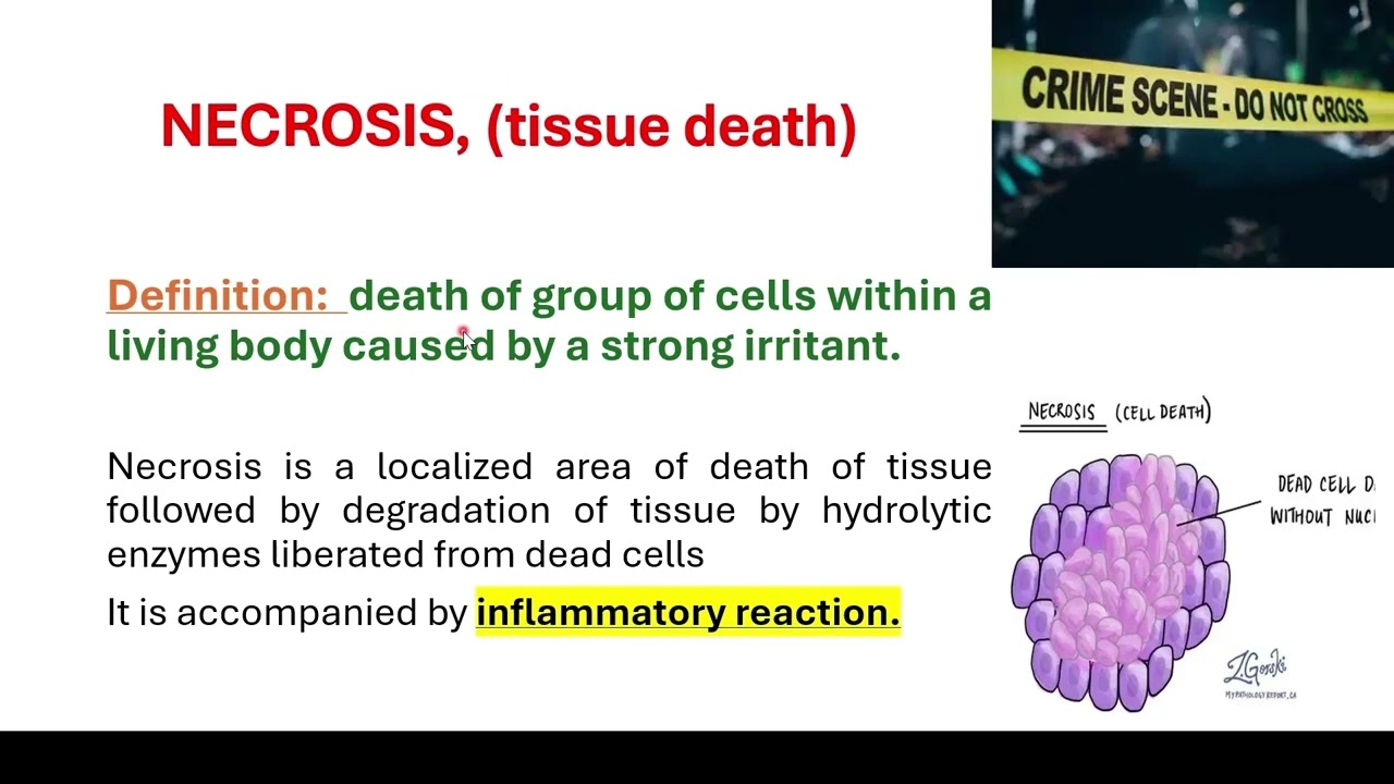 Definition of necrosis, cell death (cell injury)