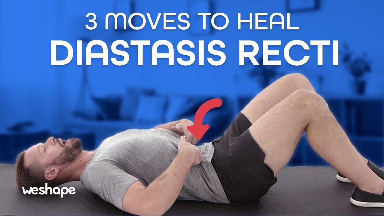 3 Moves To Heal Diastasis Recti