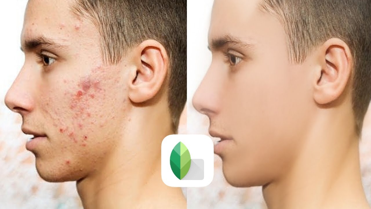 Skin smoothing , face smooth editing Tutorial in snapseed app || How to smooth your face
