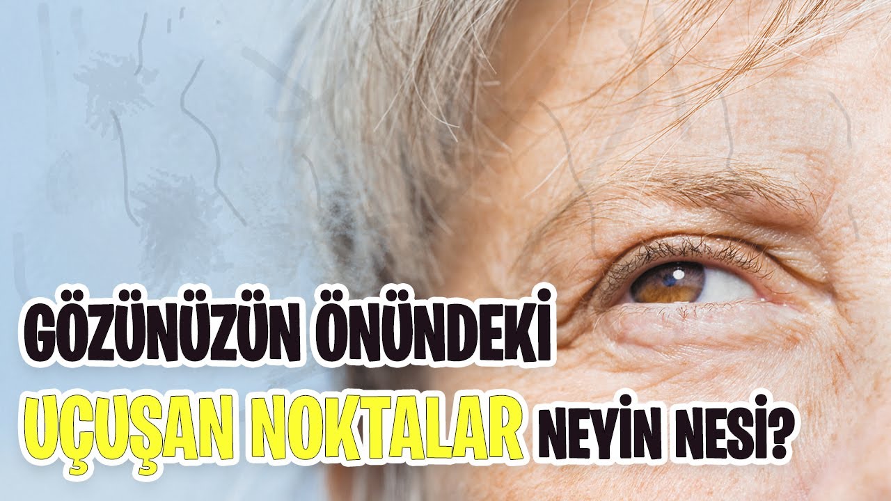 Yüzer Noktalar Nedir? Gözünüzün Önünde Uçan Şekiller Neyin Nesi?!