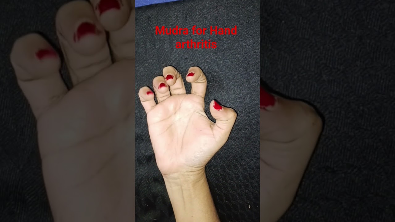 Mudra for hand arthritis 