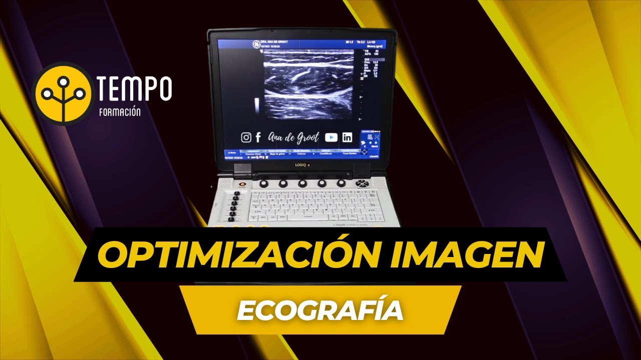 ¿Cómo mejorar la calidad de mi ecógrafo? Optimización de imagen ecografía #ecografia #tempoformacion