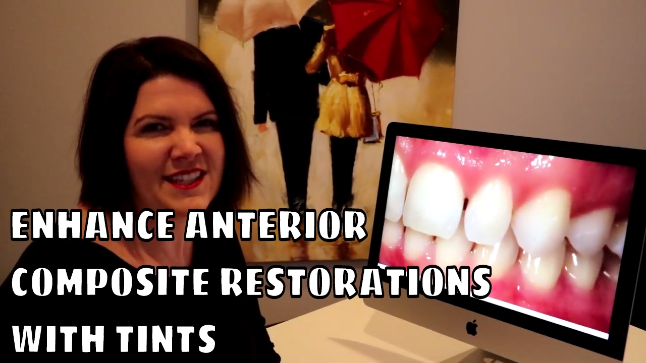 Enhancing Anterior Composite Restorations with Tints