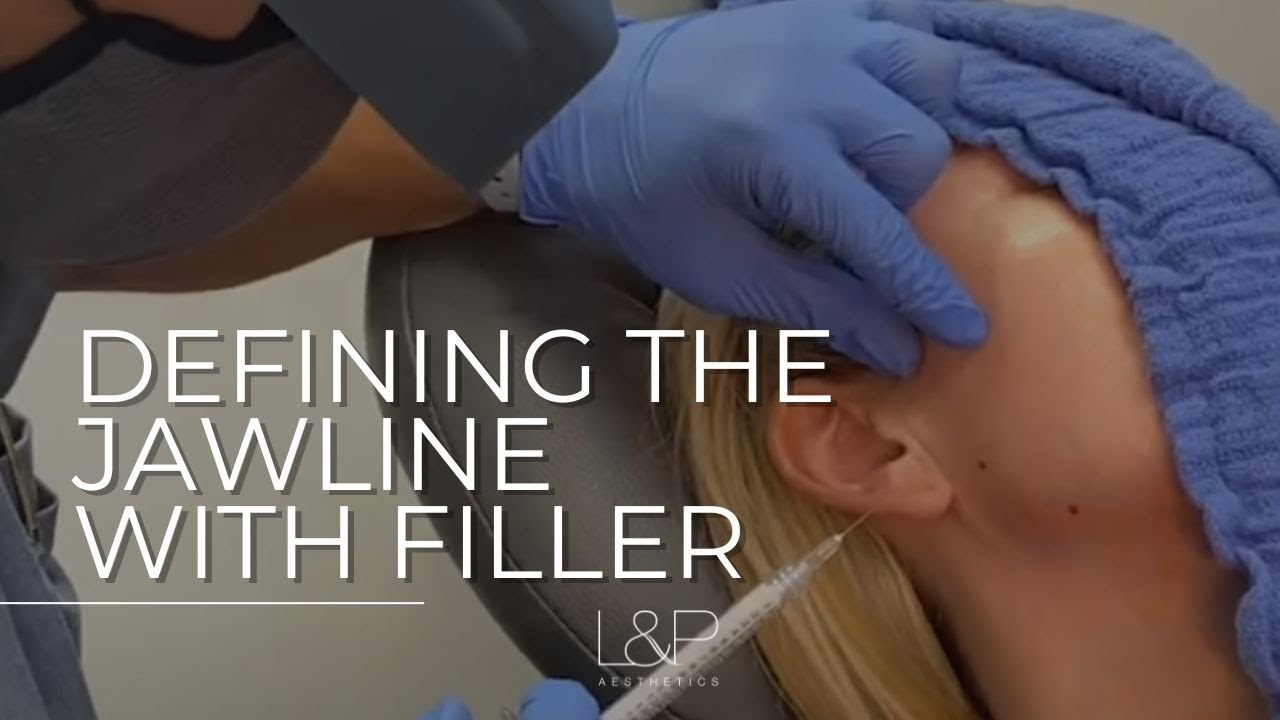 Fillers to define the jawline at L&P Aesthetics | Bay Area