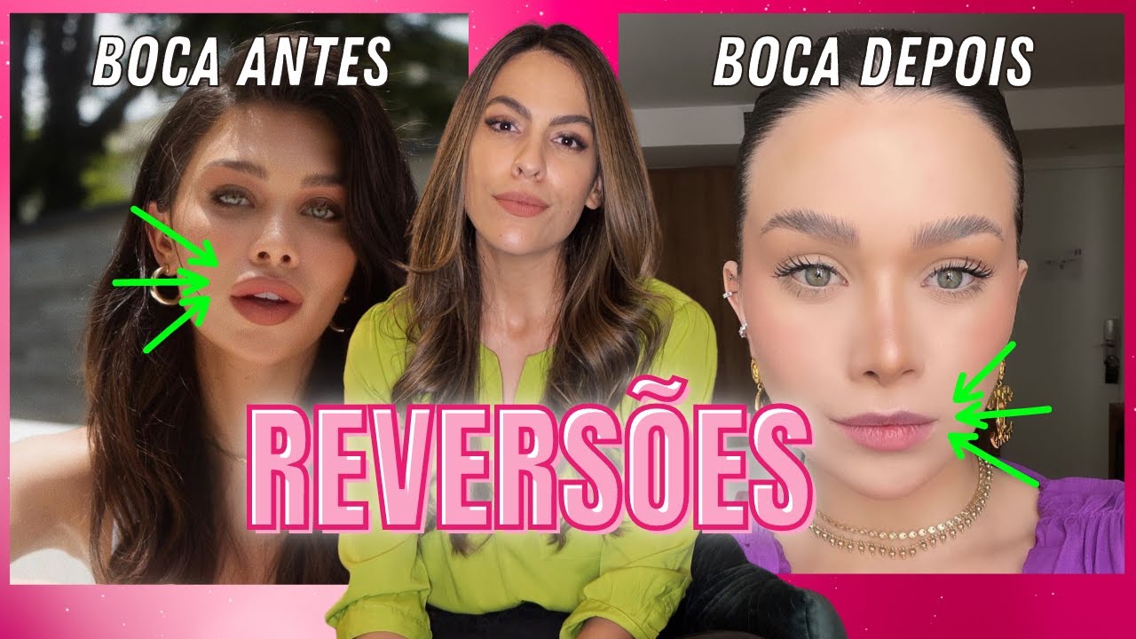 PORQUE ESTÃO TIRANDO A HARMONIZAÇÃO FACIAL?