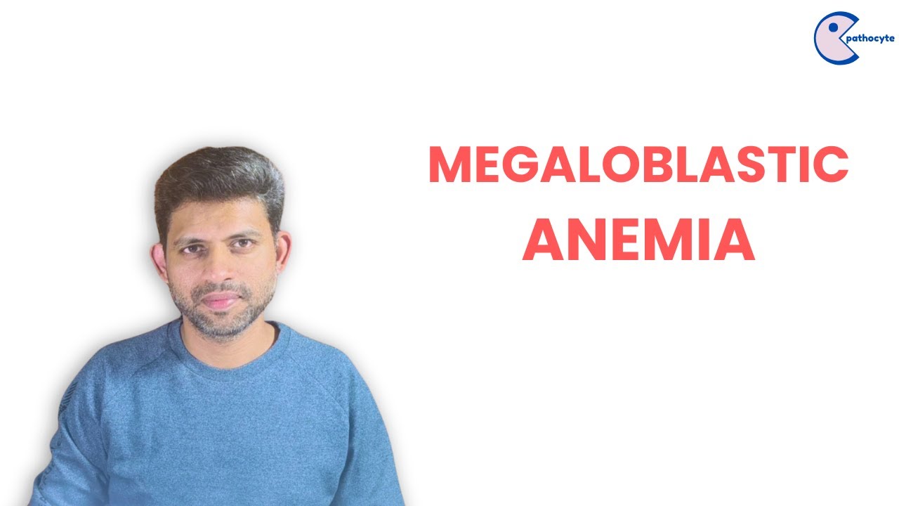Megaloblastic Anemia | Robbins Pathology