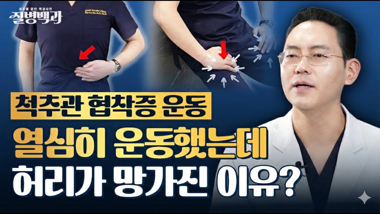 척추관협착증 운동, 열심히 운동했는데 허리가 더 망가진 이유? @제애정형외과 (#척추관협착증 #척추관협착증치료 #척추관협착증운동 #척추협착증 #황색인대제거술 #황색인대박리술)