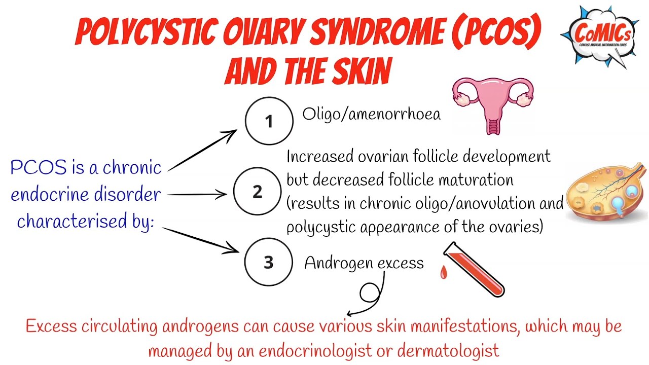 CoMICs Episode 53: PCOS and the skin