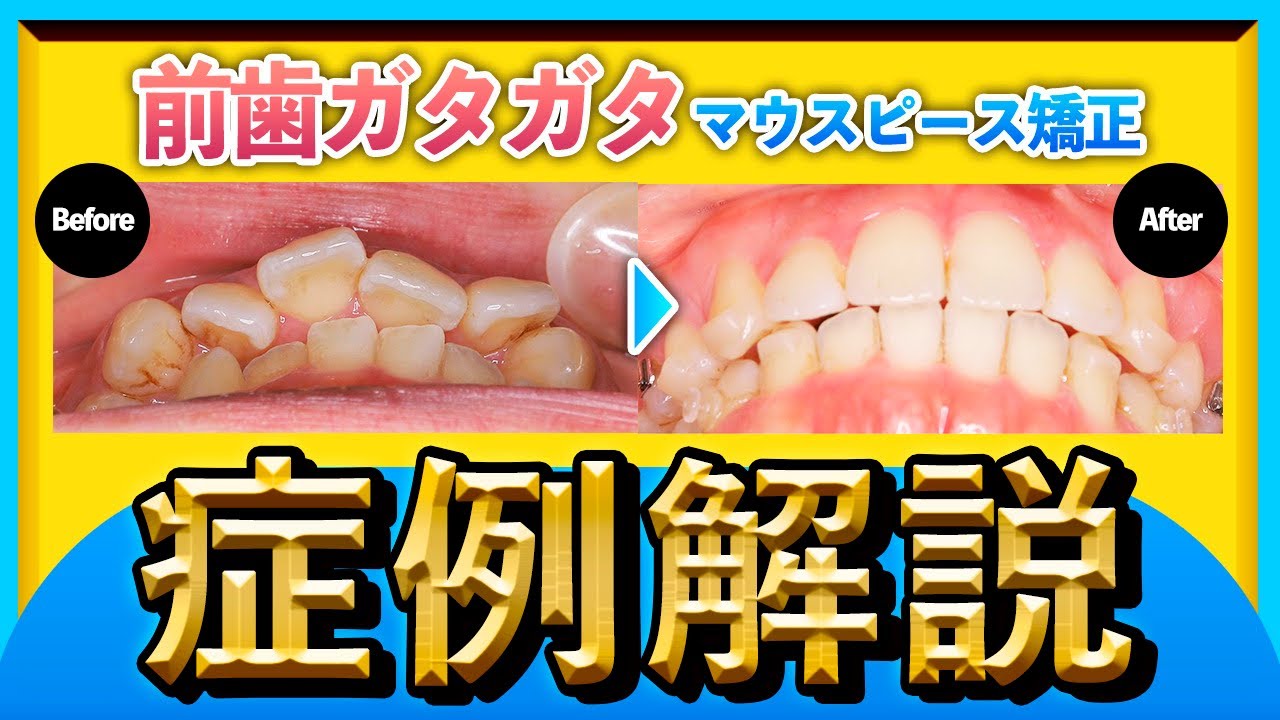 【後編】インビザライングローバルに掲載されました！
