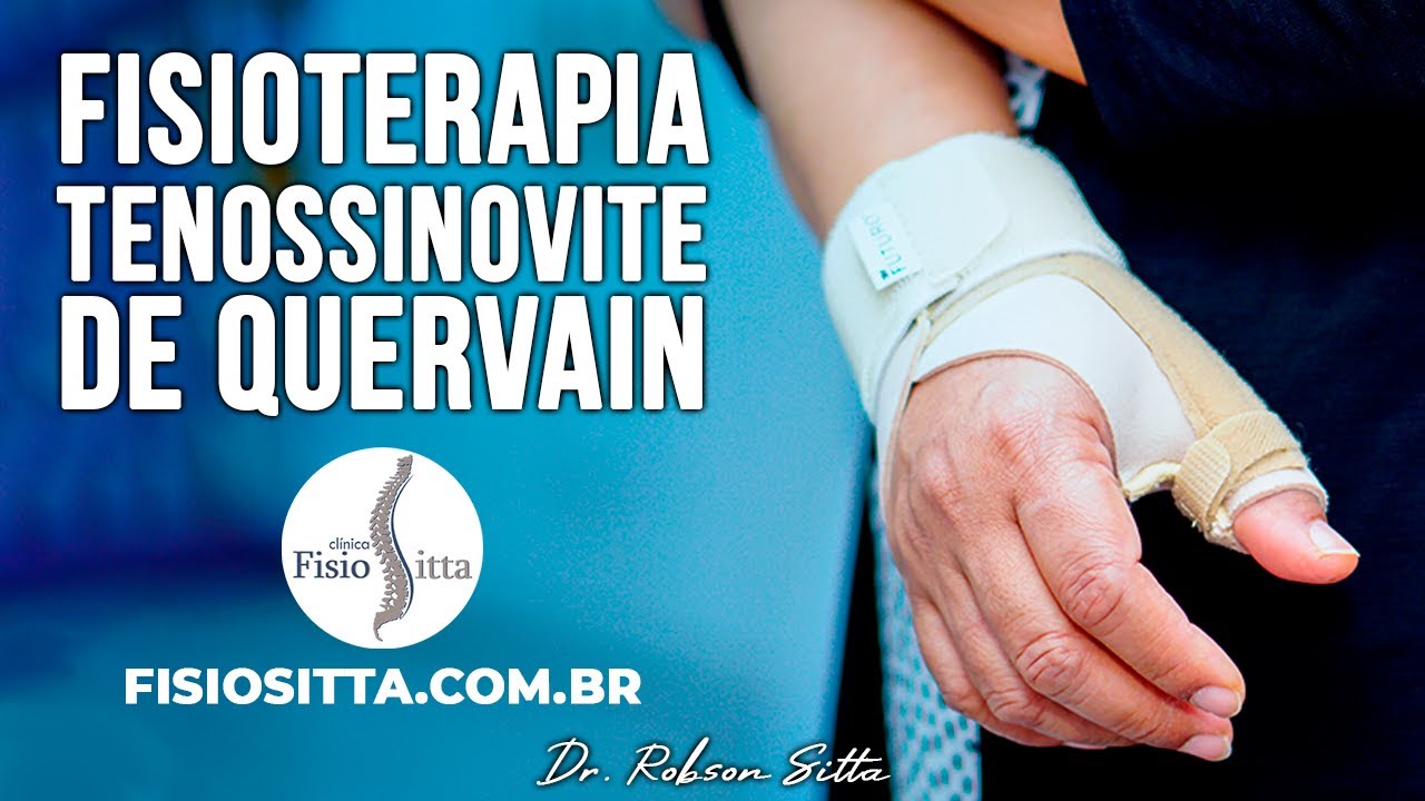 EXERCÍCIOS TENOSSINOVITE DE QUERVAIN TRATAMENTO  de FISIOTERAPIA Clínica Dr. Robson Sitta
