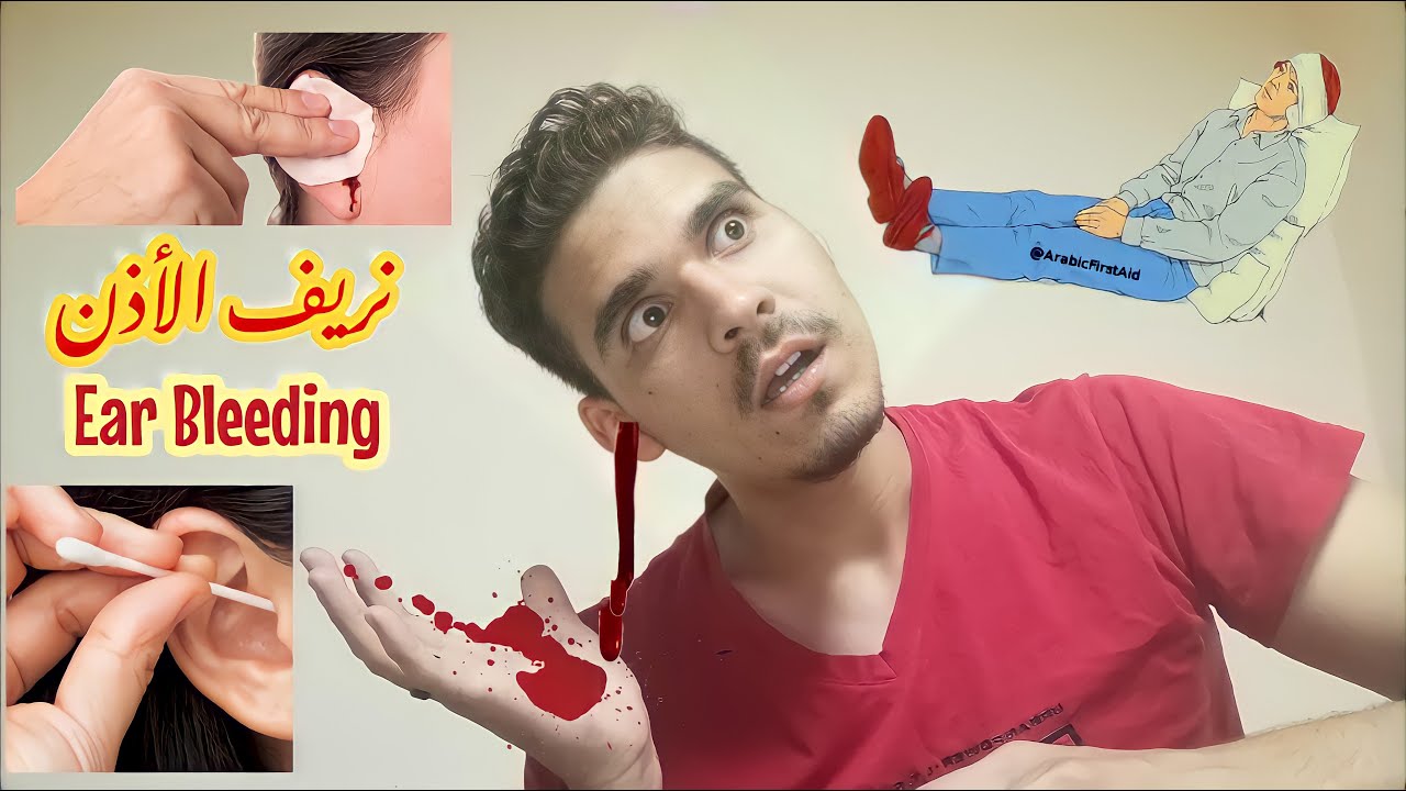 اسعافات نزيف الاذن وعلاجه , أسبابه وأعراضه - Ear bleeding first aid and treatment, causes, symptoms