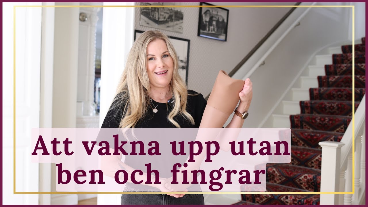 Semestern blev en mardröm, blev tvungen att amputera fingrar och ben