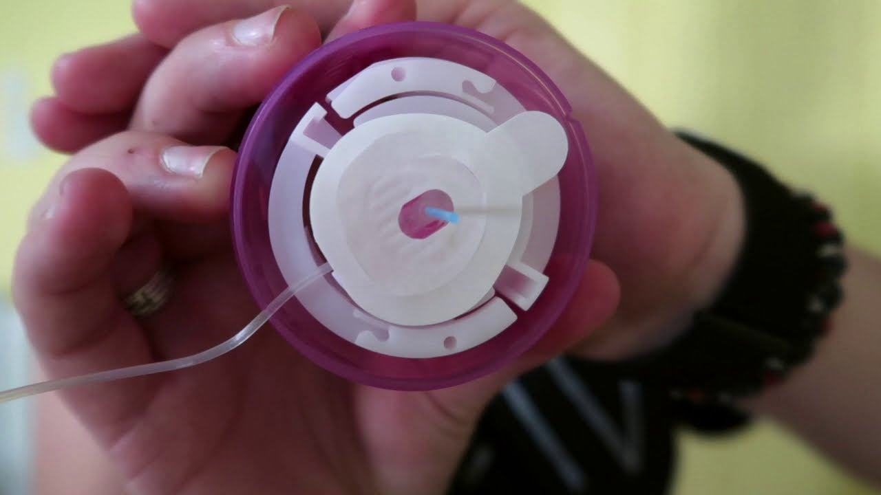 Changing my Insulin Pump Site! |Monday | Lindsey|