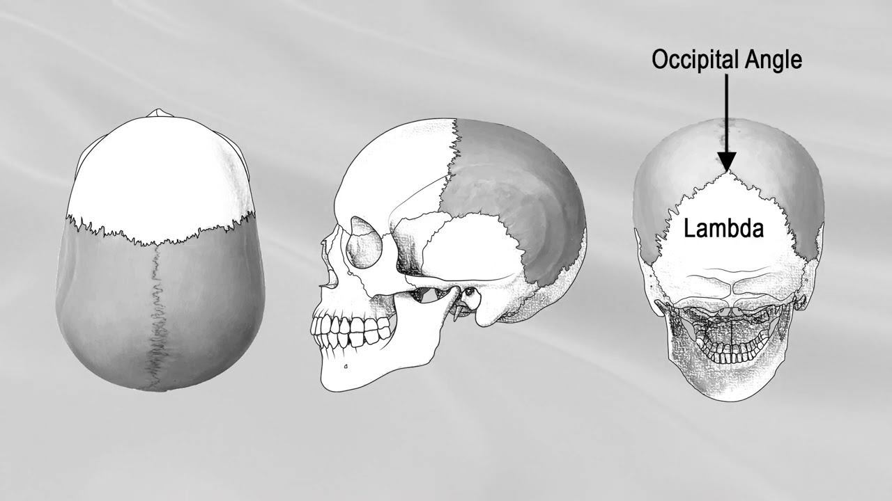PARIETAL BONE