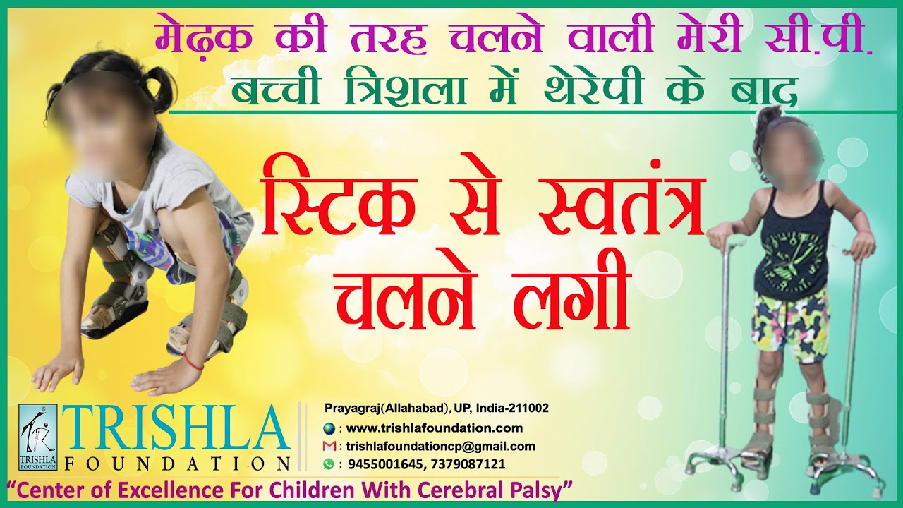 My CP Child started doing all the work & walking with walker after therapy at Trishla: Parents