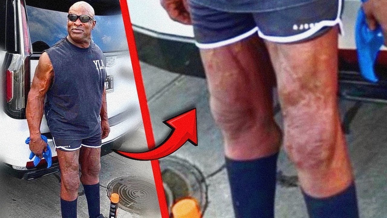 ¡¿QUÉ CAR4J0S PASÓ con LAS PIERNAS de RONNIE COLEMAN !?