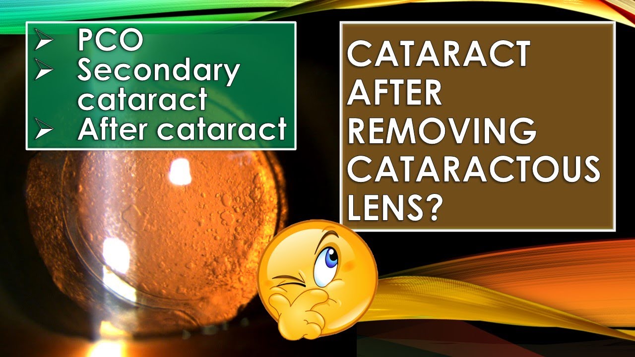 Posterior capsular opacification (PCO) and Nd YAG posterior capsulotomy