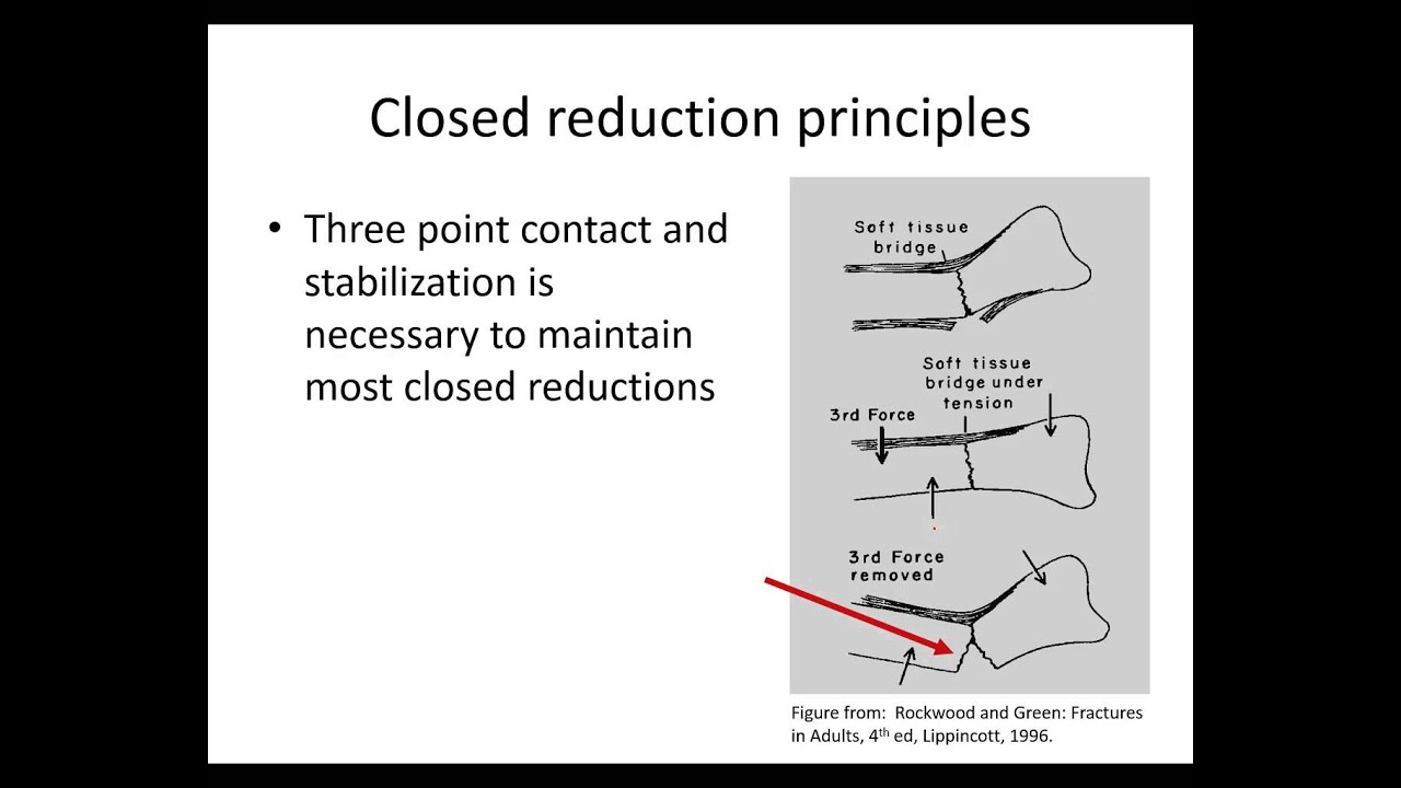 Orthopaedic trauma for med students 6