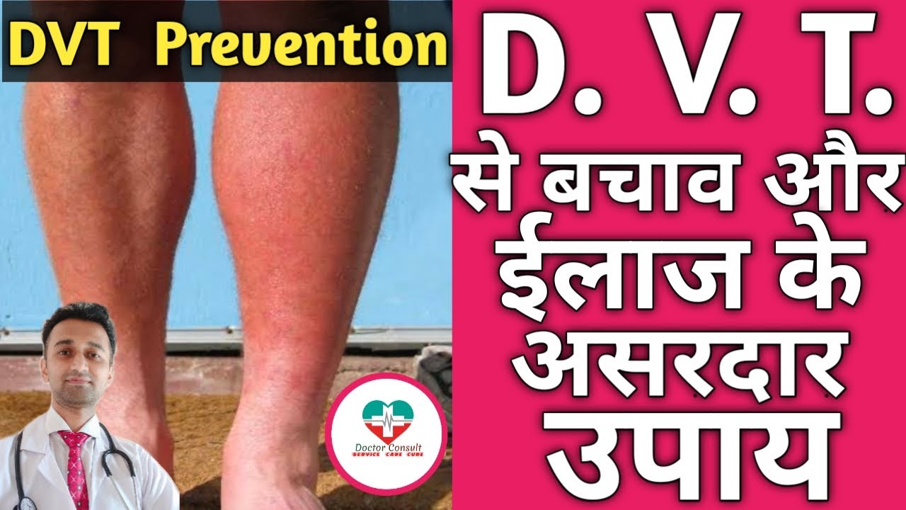 Deep Vein Thrombosis Prevention! DVT से बचाव के सही ऊपाय। D.K.S.Chougule.