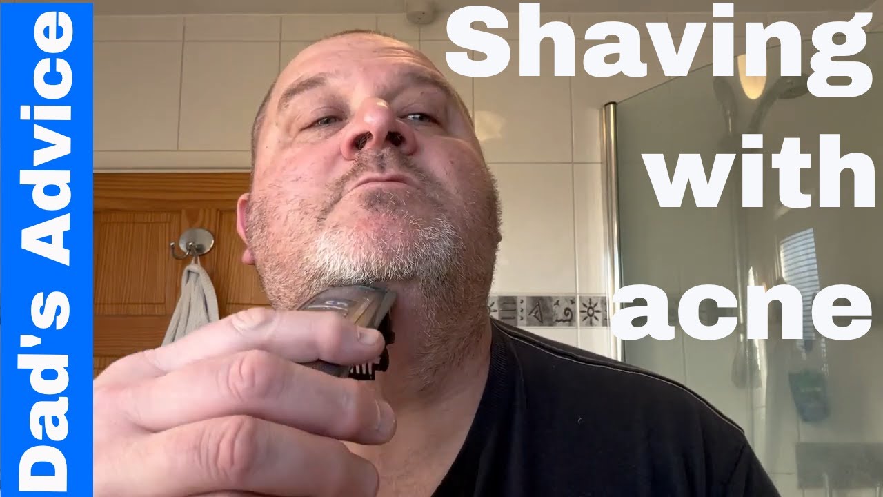 Dad's Advice - How to shave when you have spots / pimples / acne
