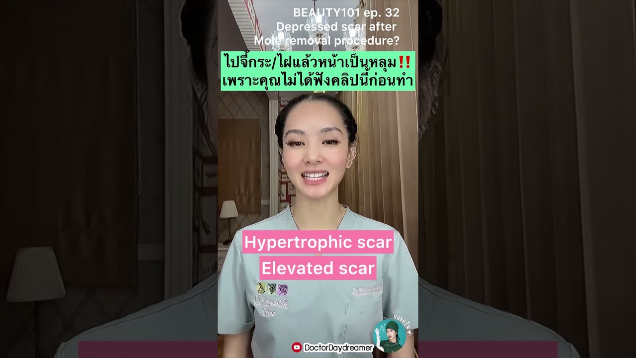 ไปจี้ #กระ #ไฝ มาหน้าเป็นหลุม‼️ เพราะคุณไม่ได้ดูคลิปนี้ก่อนทำ⁉️  | DOCTOR DAYDREAMER BEAUTY101 ep.32