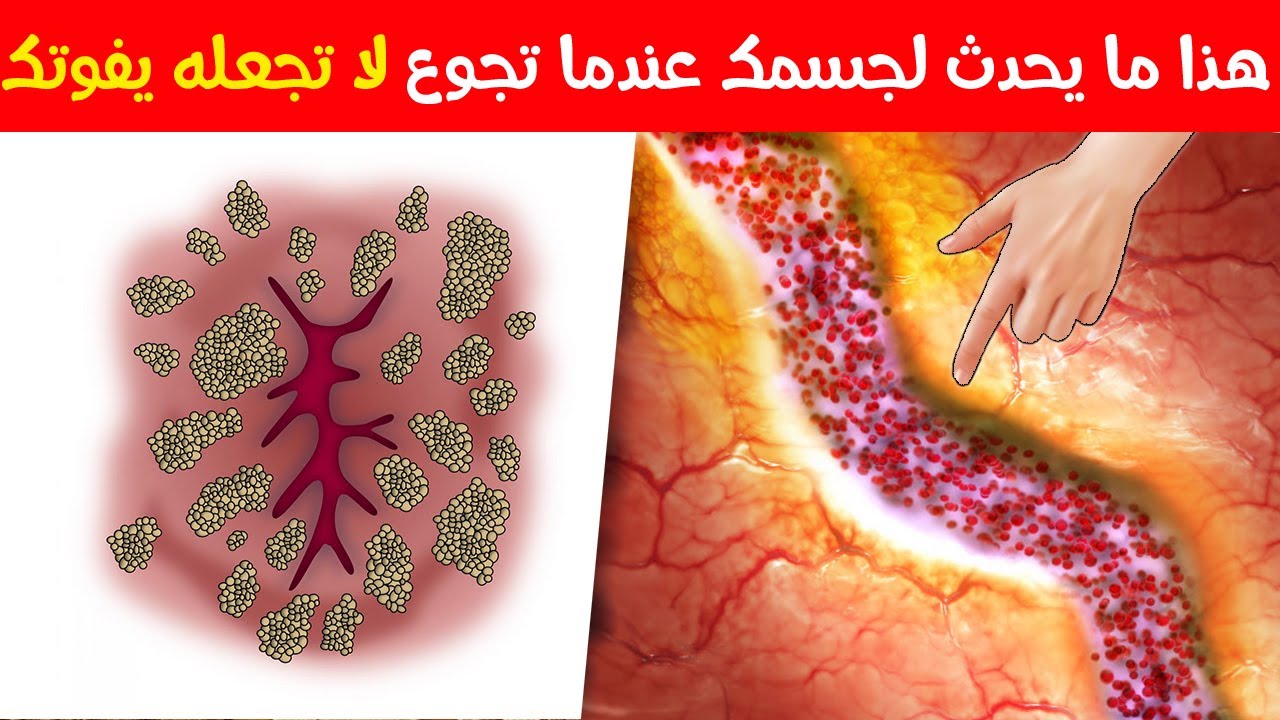 معجزة يؤكدها العلم الحديث ماذا  يحدث في الجسم أثناء الصيام هذا ما يحدث لجسمك عندما تجوع. فيديو مذهل