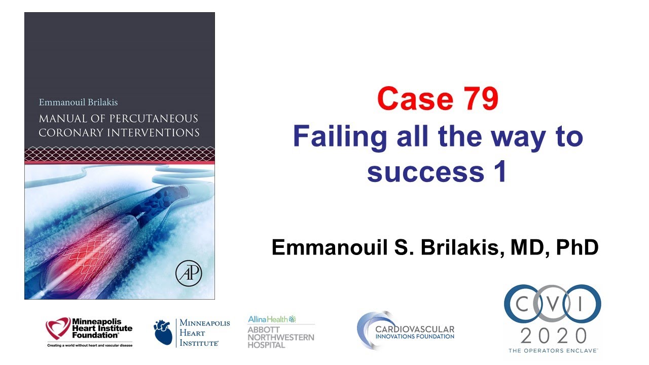 Case 79: PCI Manual - Failing all the way to success 1