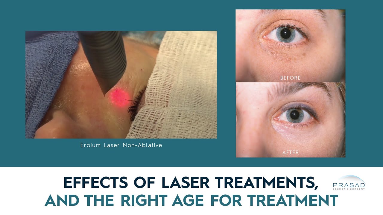 Various Effects of Cosmetic Laser Treatment, and the Right Age for Laser Skin Treatment