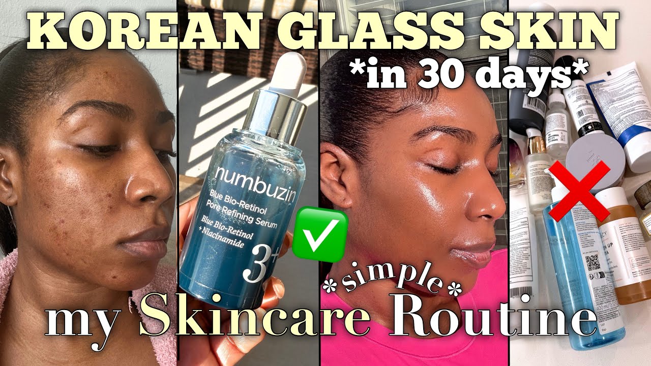THE SKINCARE ROUTINE THAT FINALLY CLEARED MY ACNE & HYPERPIGMENTATION | KOREAN SKINCARE + GLASS SKIN