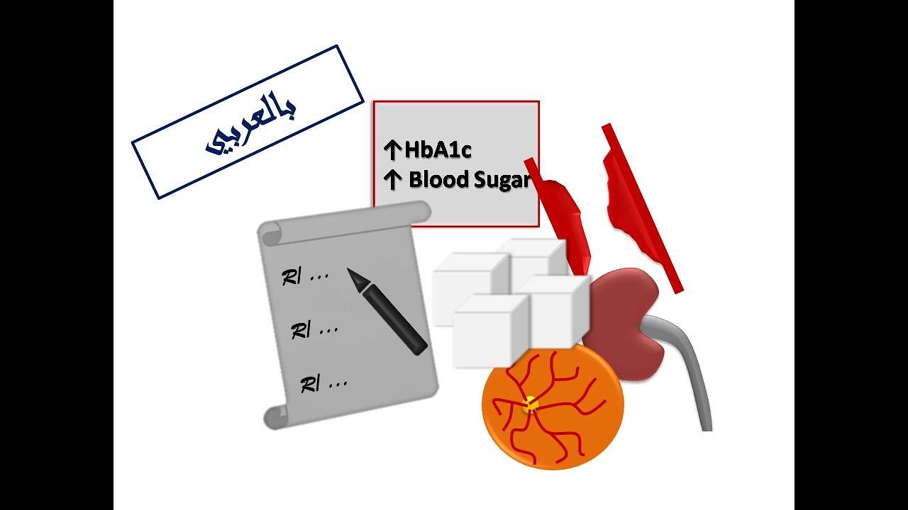 ESC Guidelines: Controlling Diabetes (Arabic Version)