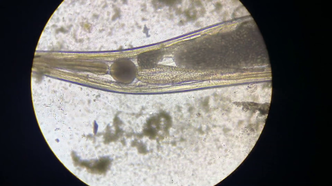 Pin Worm Egg Hatching