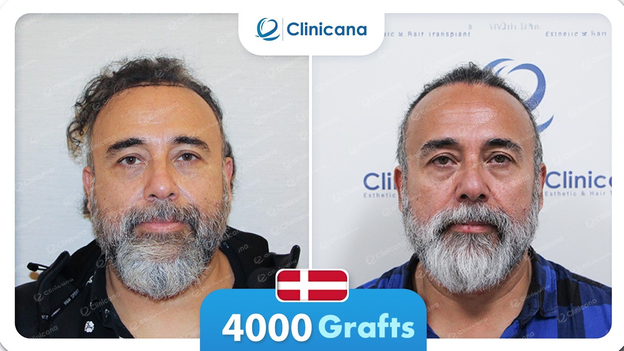 Mr. Morales Shares His Amazing Final Result