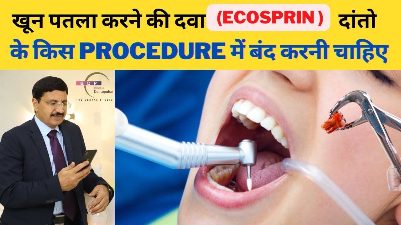 खून पतला करने की दवा (ECOSPRIN )दांतो के किस PROCEDURE में बंद करनी चाहिए #teeth #dental #dentist