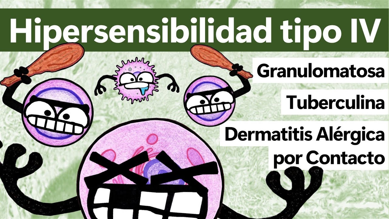 Hipersensibilidad tipo IV o Retardada | Linfocitos T y Macrófagos descontrolados