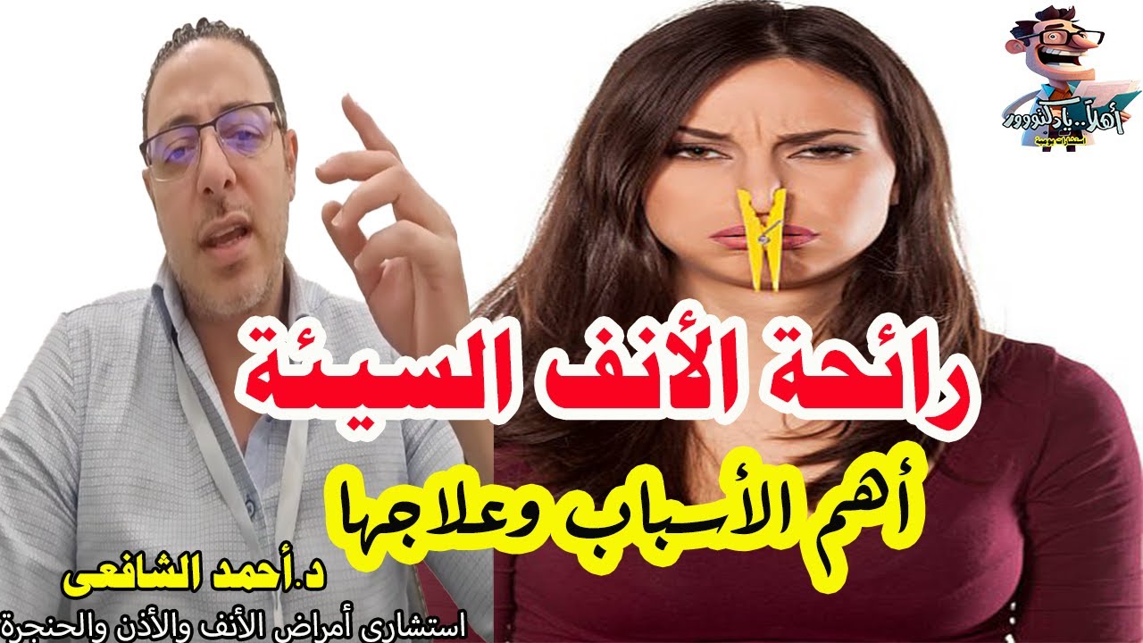 اشم رائحه كريهه في انفي ما السبب | اهلا يا دكتور تخصص امراض الأنف والأذن والحنجرة ما هو باروسميا