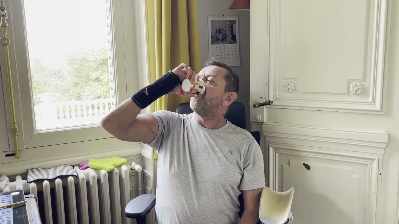 Just over one year after arm transplant