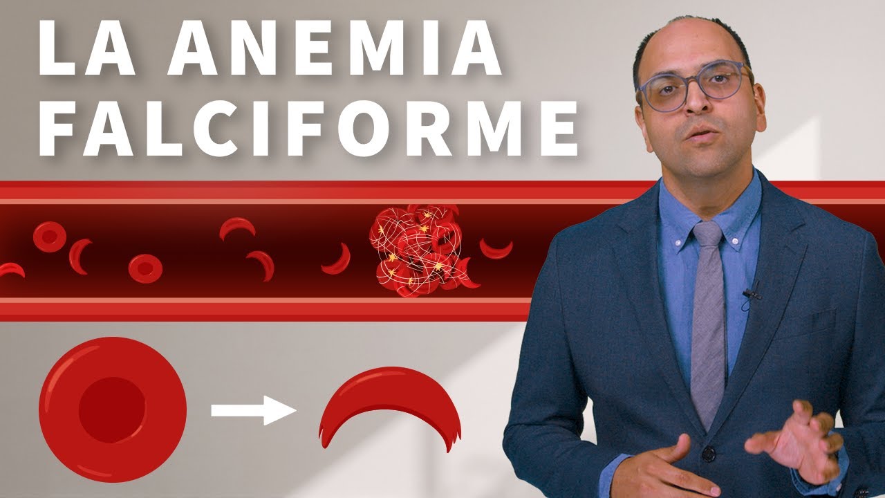 ¿Qué es la enfermedad de célula falciforme?