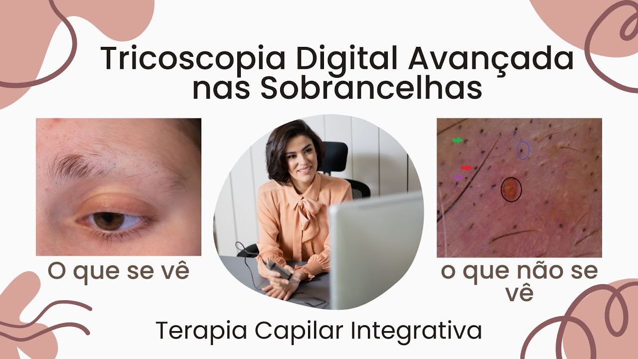 Tricoscopia Digital Avançada nas Sobrancelhas @MayraLeiteOficial