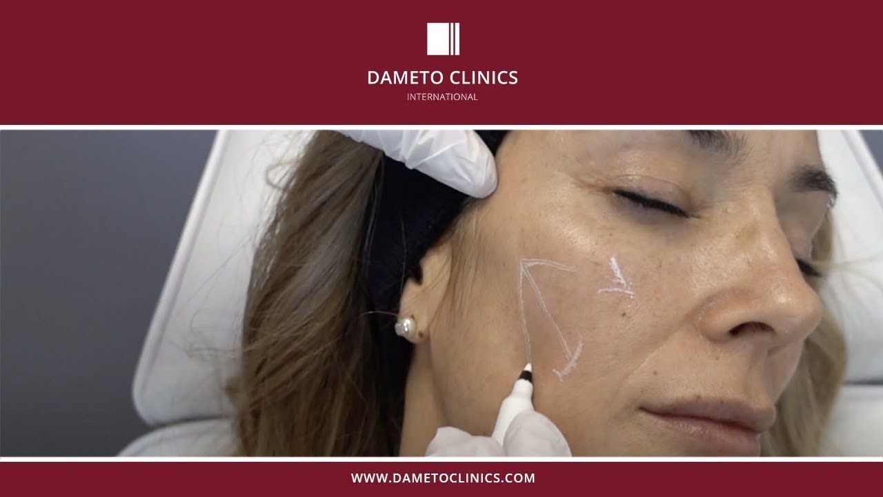 CELLBOOSTER® Lift by Dr Gabriel Siquier