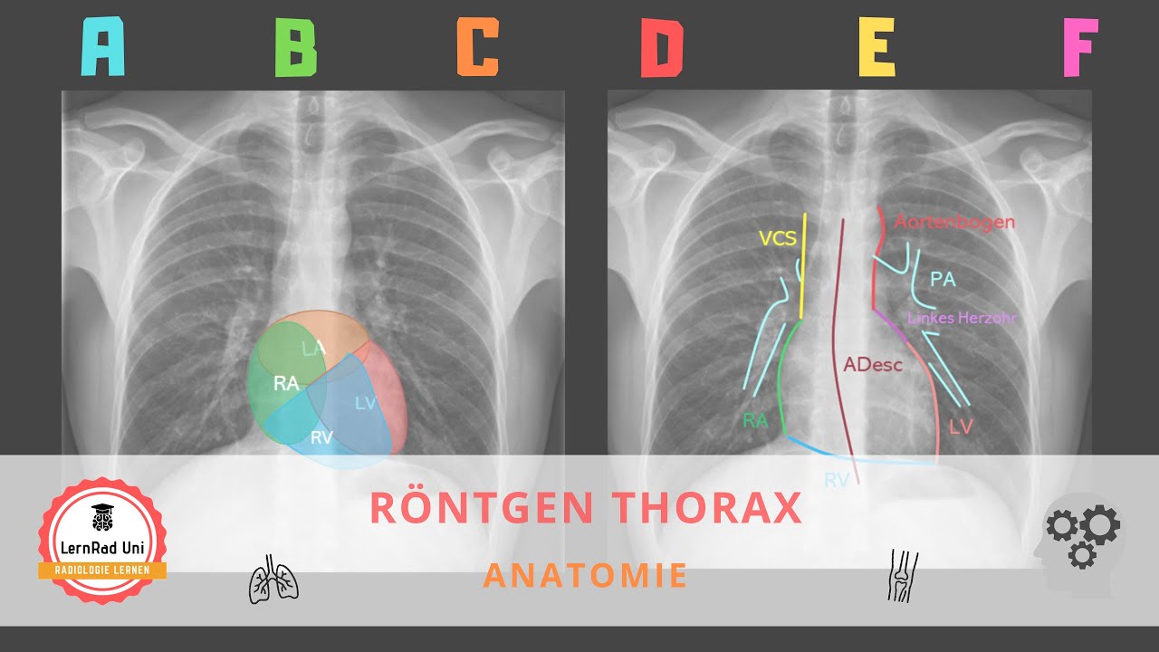 Anatomie im Röntgen Thorax – Grundlagen für Studium & Weiterbildung