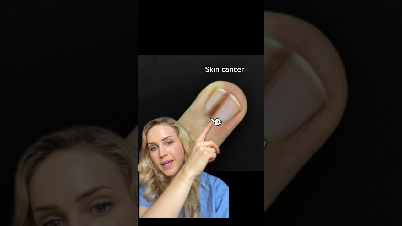 Doctor reacts: skin cancer diagnosis