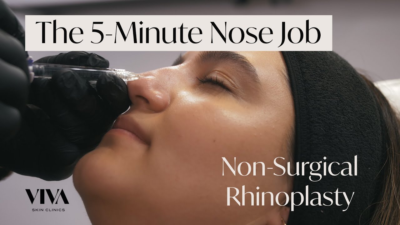 The 5-Minute Nose Job 🟡 The Non-Surgical Rhinoplasty by VIVA Skin Clinics