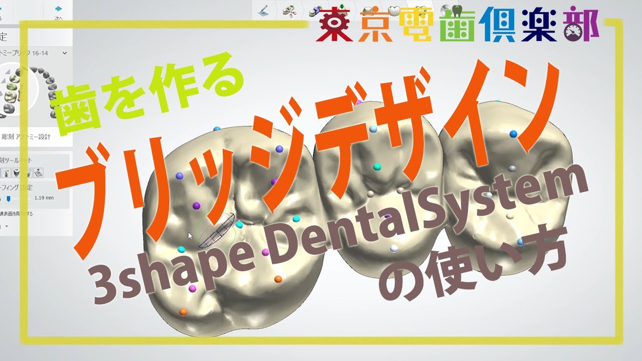 歯を作る！ブリッジデザイン 3shape Dentalsystemの使い方for Dentist