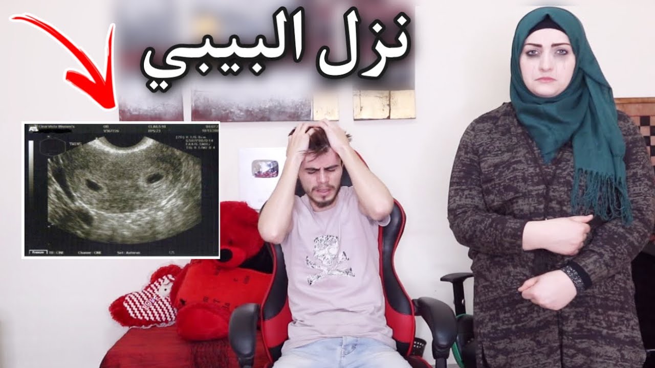 الدكتورة قلتلي لازم نزل البيبي 😭 اقوى مقلب بزوجي صار يبكي😱