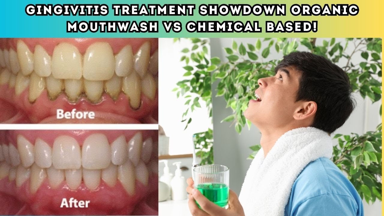 Gingivitis Treatment Showdown! 🌿 Organic Mouthwash vs  Chemical Based 💥 Which Works Best 🤔