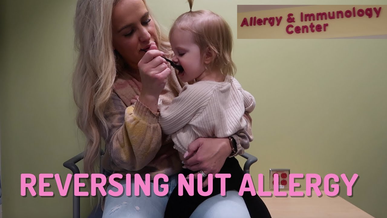 REVERSING NUT ALLERGY | ALLERGIC REACTION | Rashelle Marie