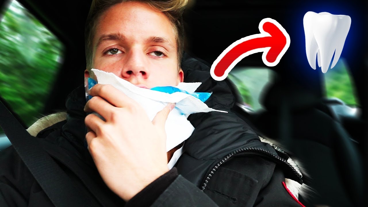 Ich bekomme meine WEISHEITSZÄHNE raus !! 🤢
