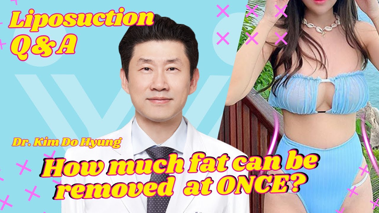 How much fat can be removed at once? | Liposuction Q&A | Dr. Kim Do Hyun