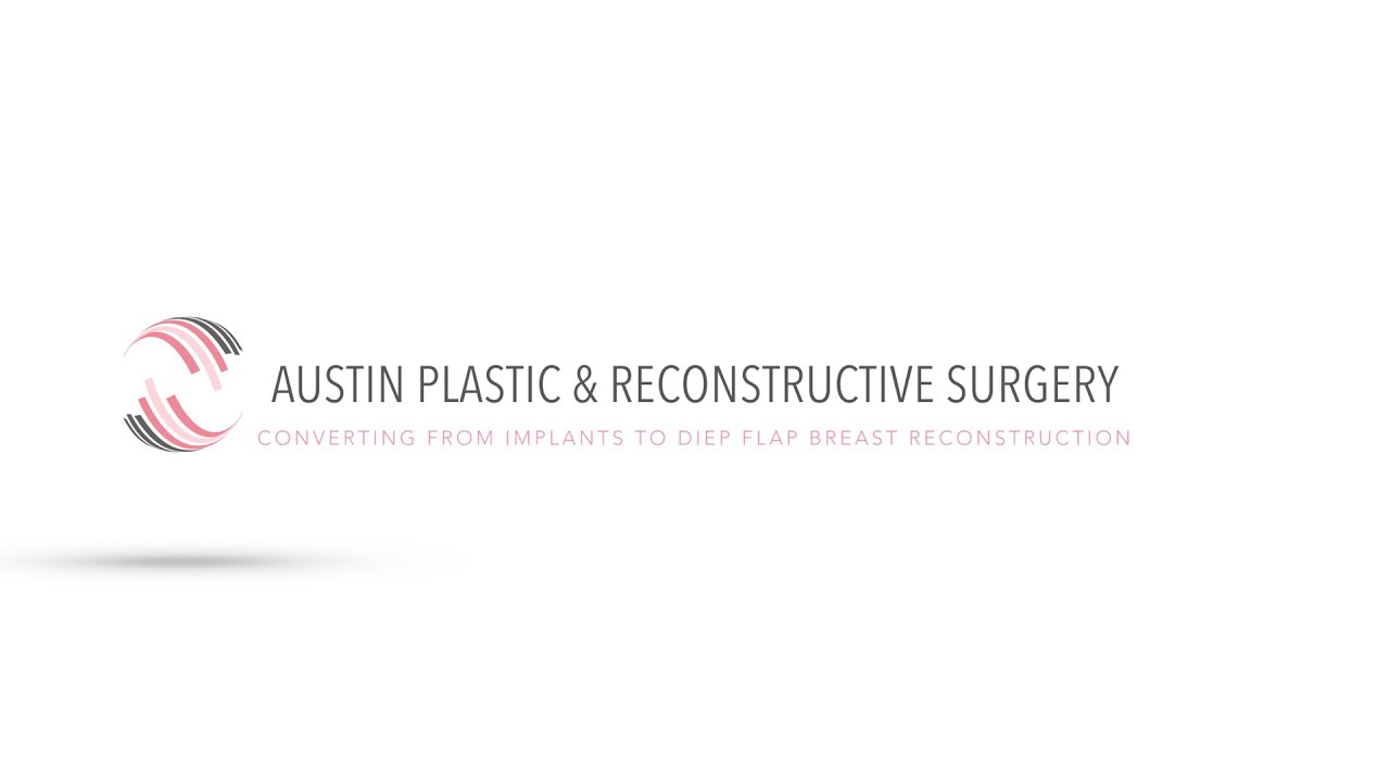 Converting from Implants to DIEP Flap Breast Reconstruction